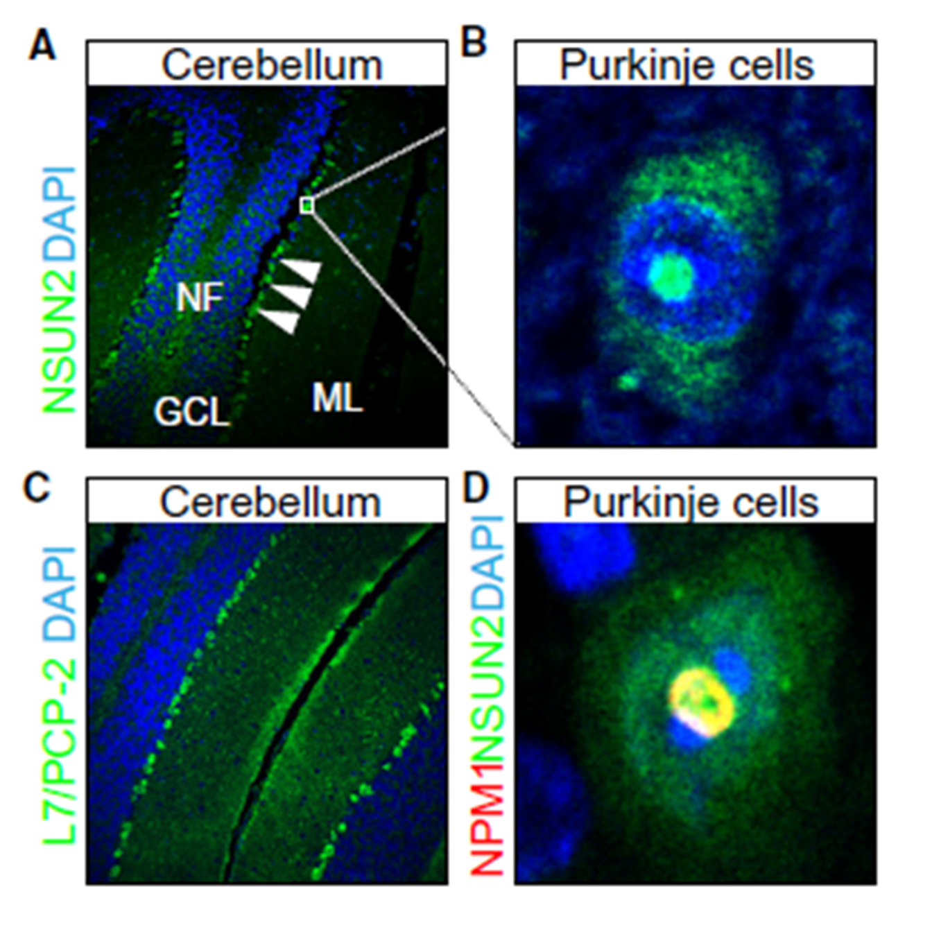 Identification of genes for autism and intellectual disability